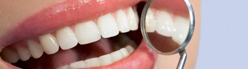 Smile Makeovers on the Gold Coast: Whatโs Involved and How Long Does It Take?