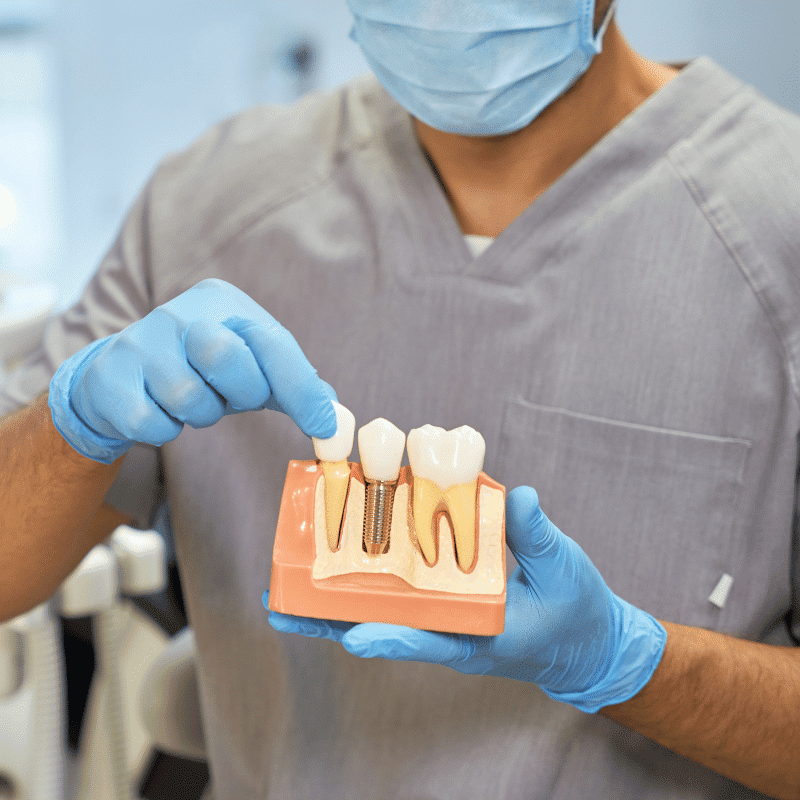 define-dental-dental-implants | Define Dental Dental clinician in scrubs and mask demonstrates placing a crown on an implant on a dental model.