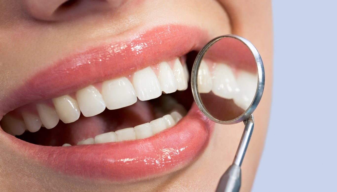 Smile Makeovers on the Gold Coast: What’s Involved and How Long Does It Take?